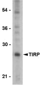 TICAM2 / TRAM Antibody