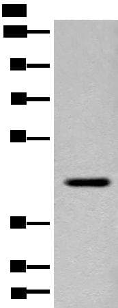 Polyclonal Rabbit anti-Human FAM105A Antibody (WB)