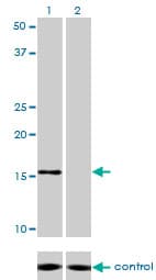 NDUFB7 / B18 Antibody (clone 4D4)