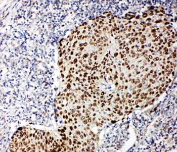 TP63 / p63 Antibody (aa664-680)