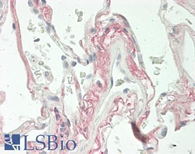 IHC-plus™ Polyclonal Rabbit anti-Human COL8A2 / Collagen VIII Antibody (aa571-599, IHC, IF, WB)