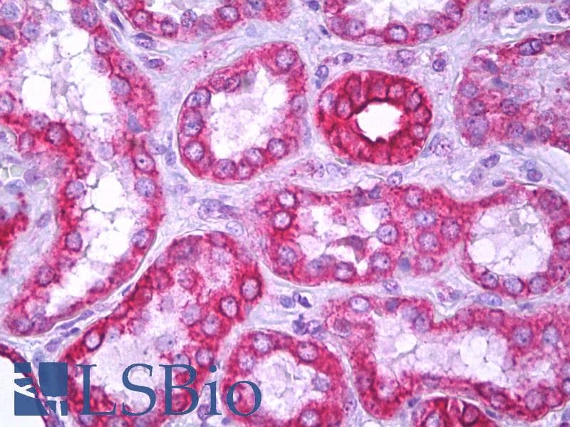 IHC-plus™ Polyclonal Rabbit anti-Human ARRDC3 Antibody (aa365-414, IHC, WB)