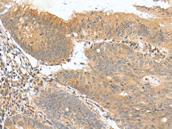 HHIPL2 Antibody