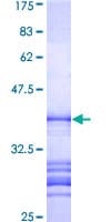 Human SIK3 / QSK Protein (Recombinant GST, N-terminus)