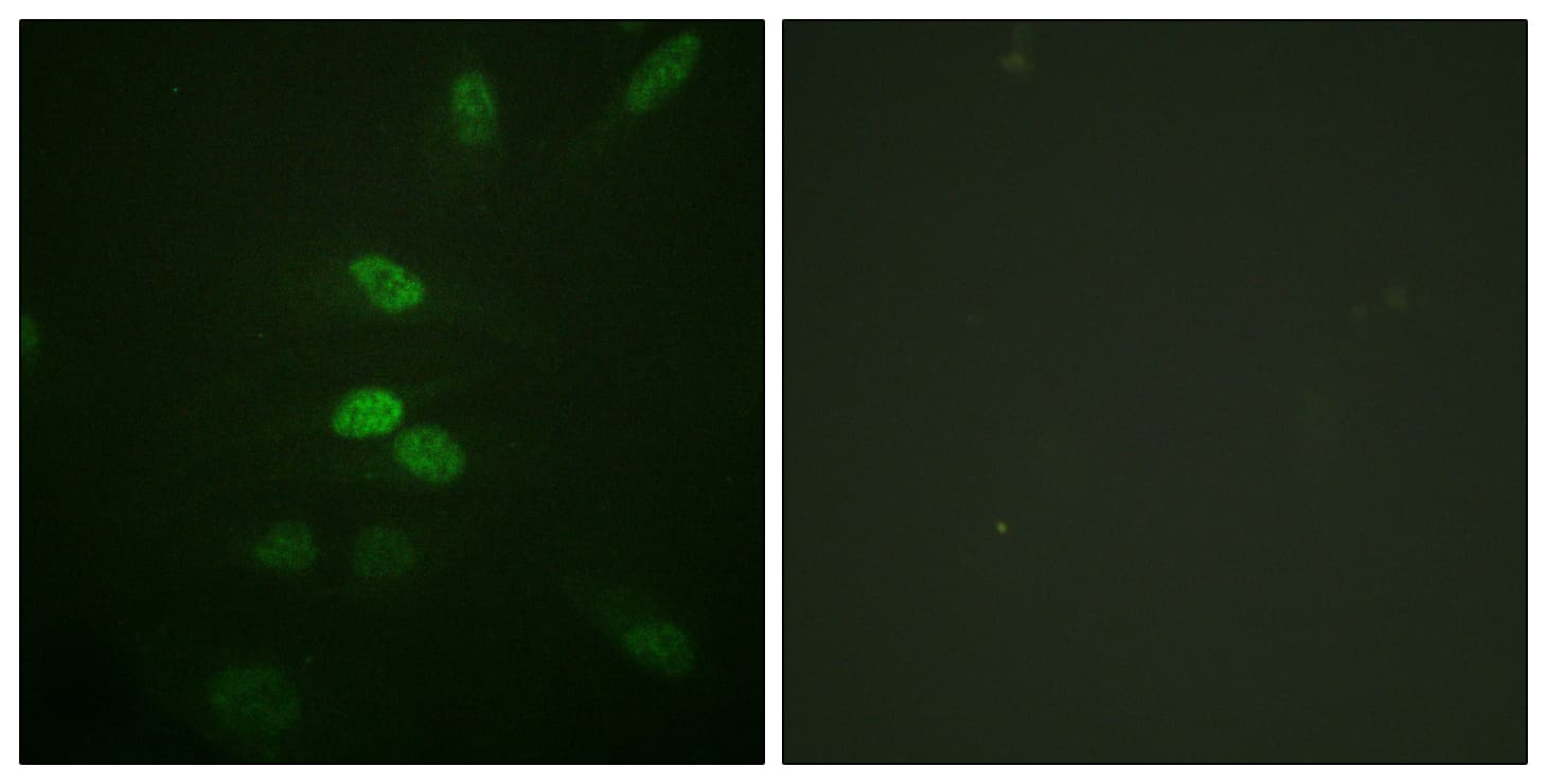 CDC25B Antibody (aa319-368)