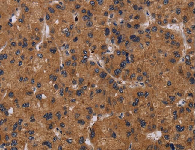 Polyclonal Rabbit anti-Human NPR2L / TUSC4 Antibody (IHC)