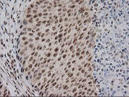 Monoclonal Mouse anti-Human MGLL / Monoacylglycerol Lipase Antibody (clone OTI1H1, IHC, IF, WB)