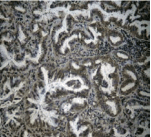 RELA / NFKB p65 Antibody