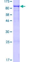 Human RUNDC1 Protein (Recombinant GST)