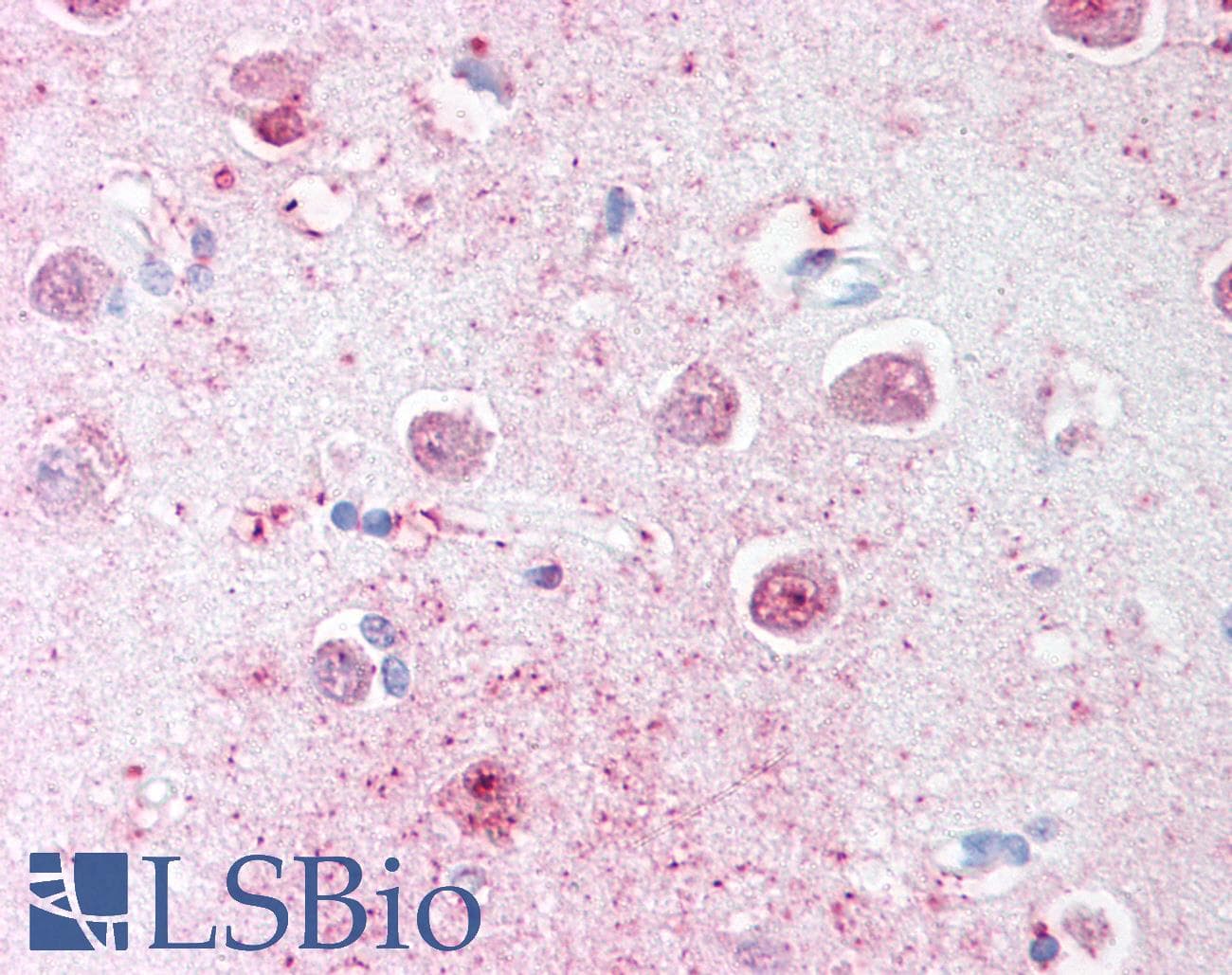IHC-plus™ Polyclonal Rabbit anti-Human LINGO1 Antibody (C-Terminus, IHC)