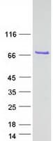 Human CXorf49B Protein (Recombinant Myc-DDK (Flag))