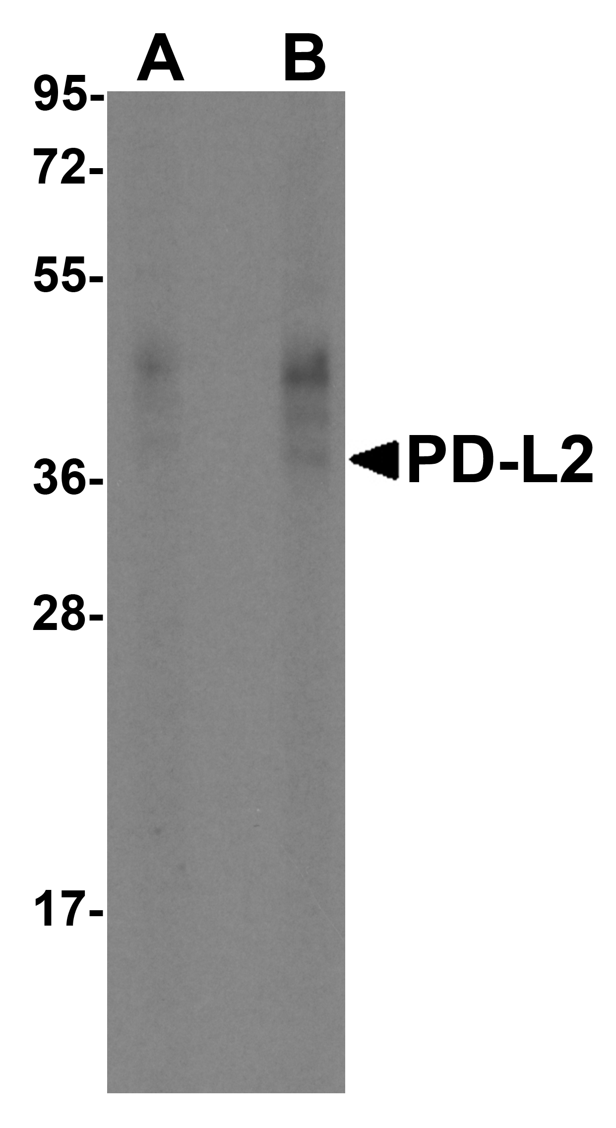 PD-L2 / PDCD1LG2 / CD273 Antibody (clone 7C1)