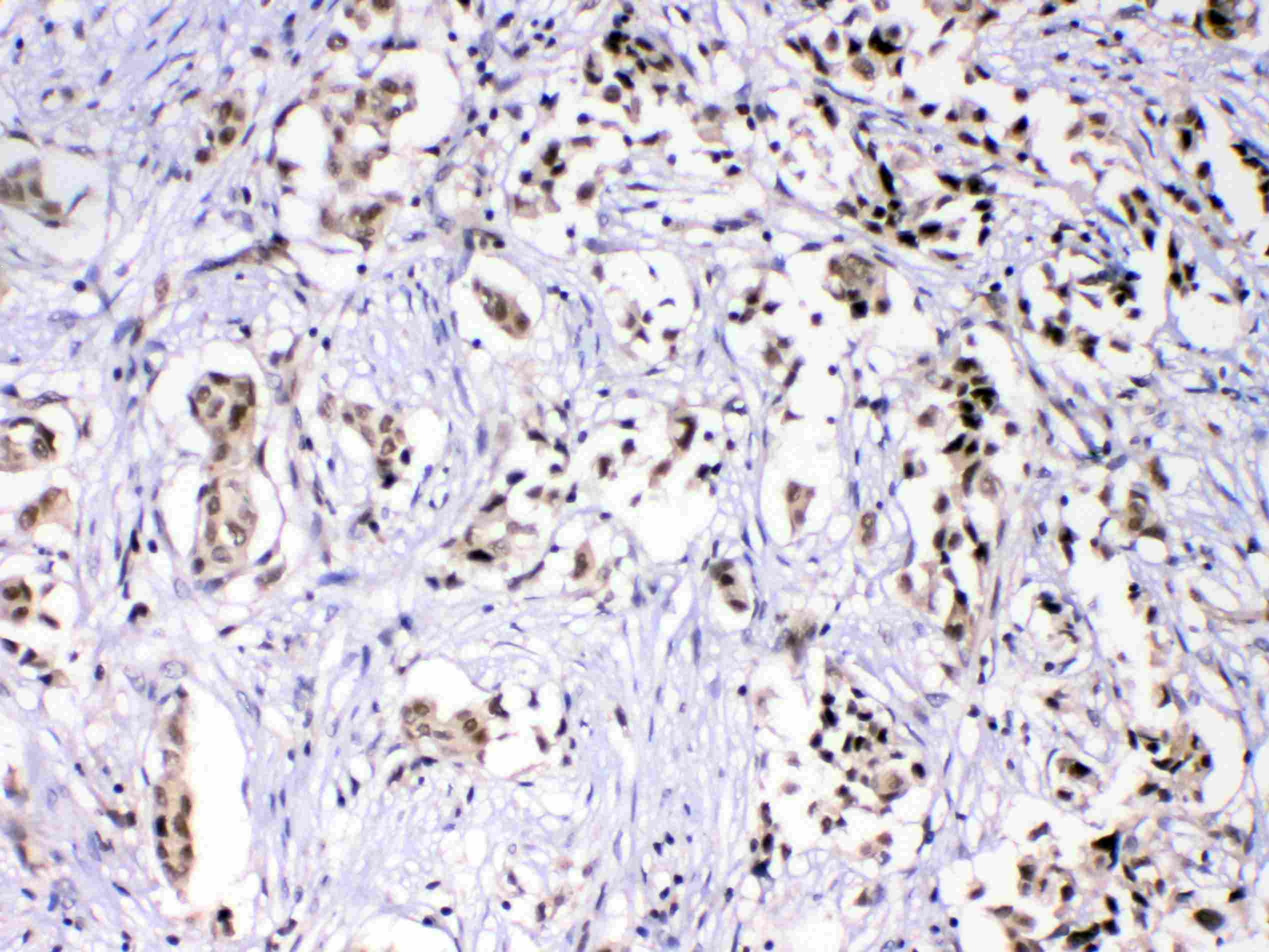 HNRNPF / hnRNP F Antibody