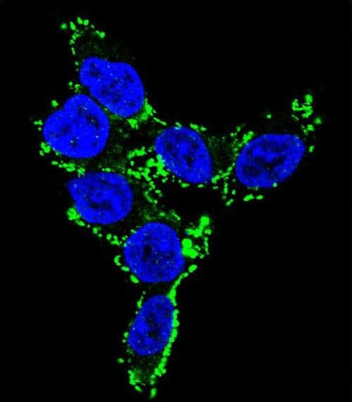 Polyclonal Rabbit anti-Human CYP2C19 Antibody (aa82-108, IHC, IF, WB)