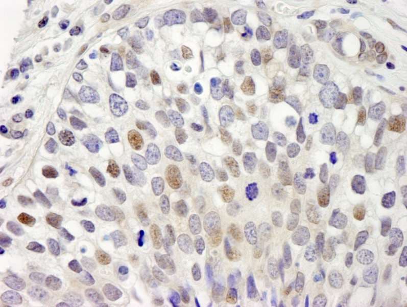 SETD1A / SET1 Antibody (aa1200-1250)