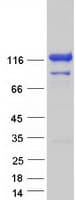 Human VCPIP1 Protein (Recombinant Myc-DDK (Flag))