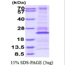 Human RPL26 / Ribosomal Protein L26 (Recombinant His)