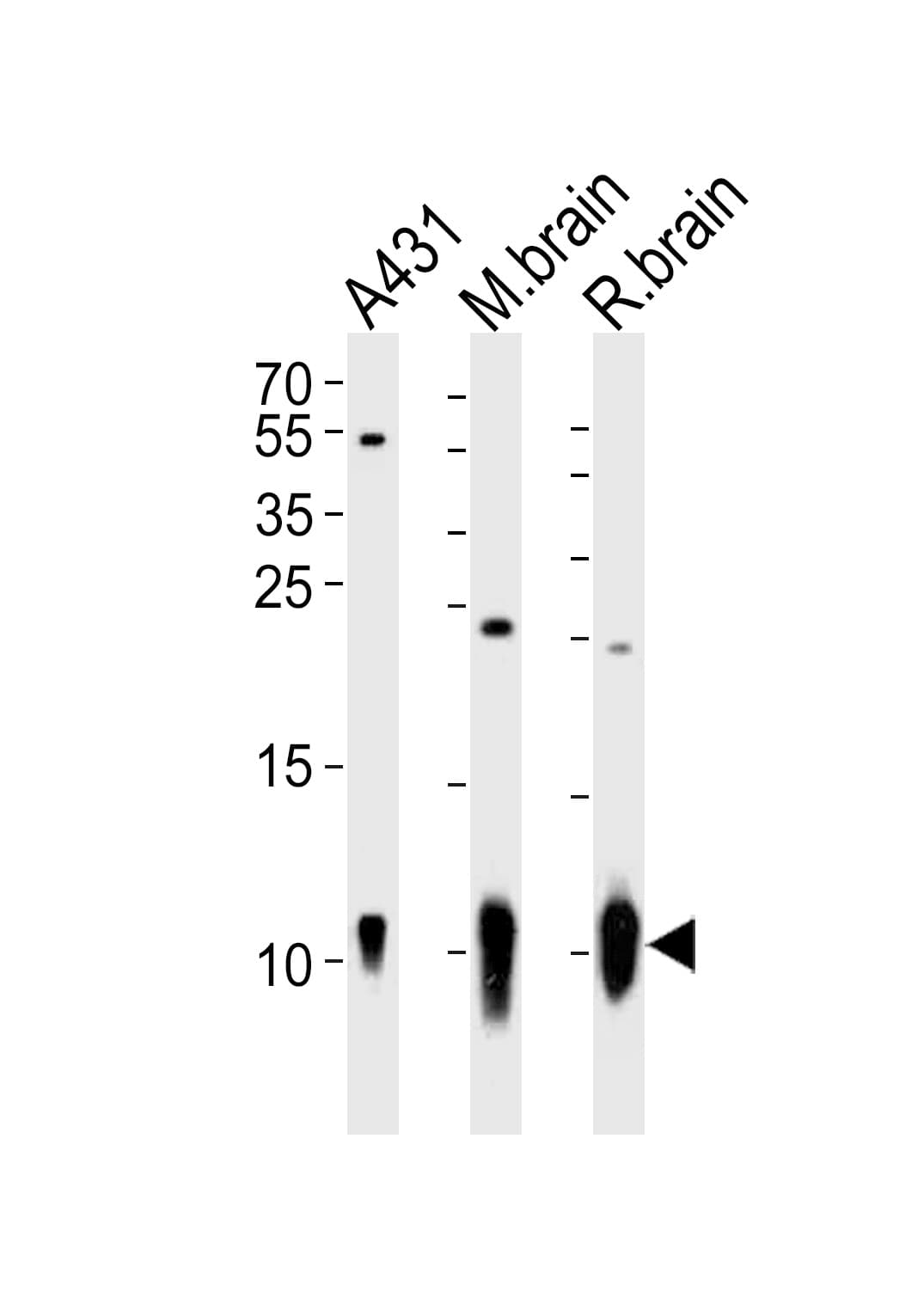 PathPlus™ S100B / S100 Beta Antibody