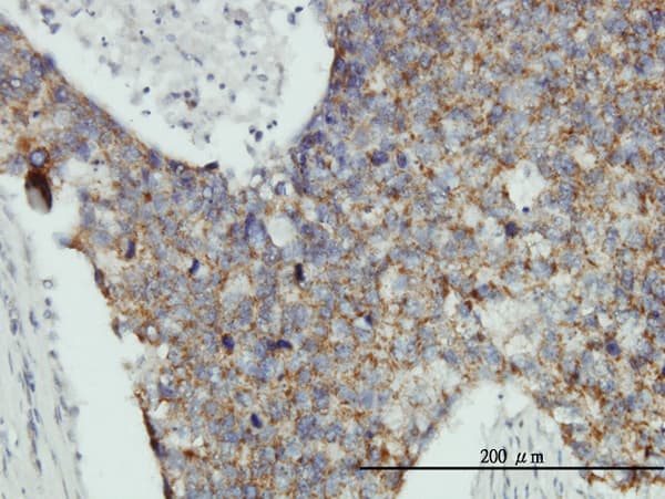 Monoclonal Mouse anti-Human MRPL12 Antibody (clone 3B12-1A3, IHC, IF, WB)