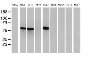 TP53 / p53 Antibody (clone OTI5E2)