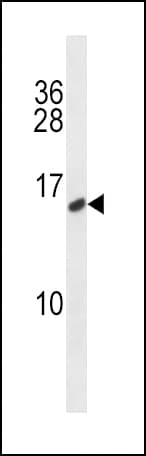 Polyclonal Rabbit anti-Human CALCA Antibody (aa104-132, WB)