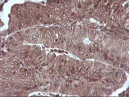 MAP2K1 / MKK1 / MEK1 Antibody (clone OTI2G5, Carrier-free)