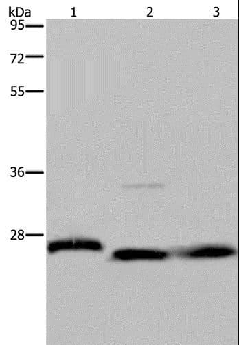 GSTP1 / GST Pi Antibody