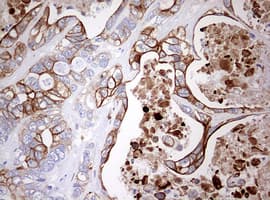 KRT20 / CK20 / Cytokeratin 20 Antibody (clone OTI11A1)