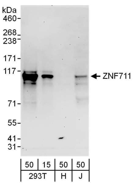 Polyclonal Rabbit anti-Human ZNF711 Antibody (aa100-150, WB)