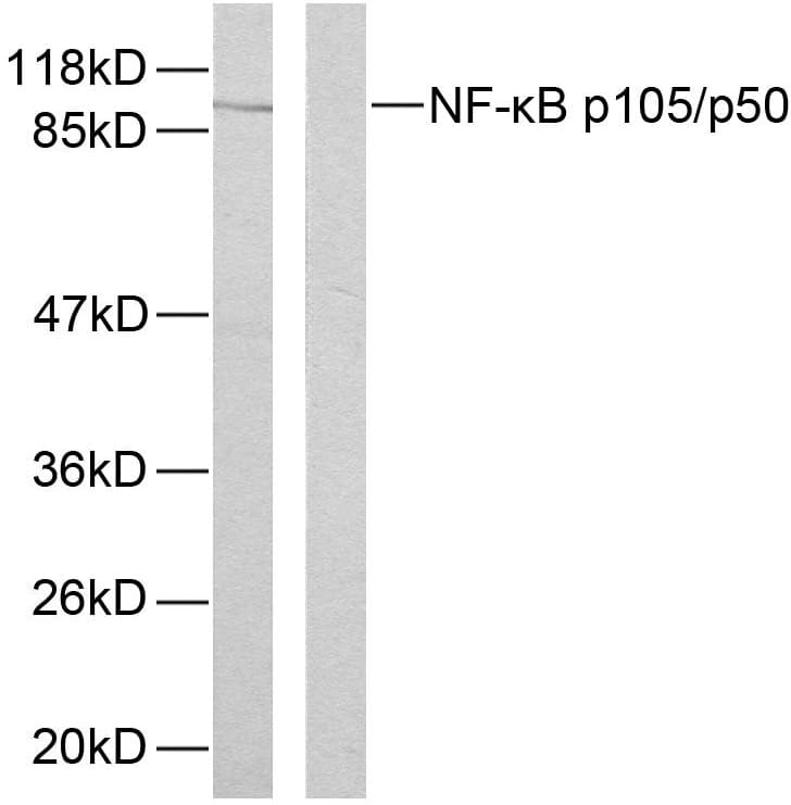 NFKB1 / NF-Kappa-B Antibody (phospho-Ser893)