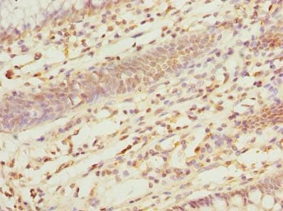 ZDHHC5 Antibody