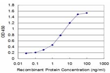 EDNRA / Endothelin A Receptor Antibody (clone 2A5)