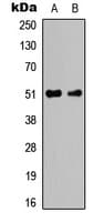 Polyclonal Rabbit anti-Human CASP2 / Caspase 2 Antibody (Internal, IHC, WB)