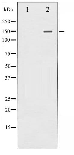 Polyclonal Rabbit anti-Human PLCG2 / PLC Gamma 2 Antibody (phospho-Tyr753, IHC, WB)