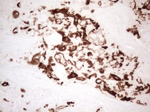 KRT16 / CK16 / Cytokeratin 16 Antibody (clone OTI2H8)