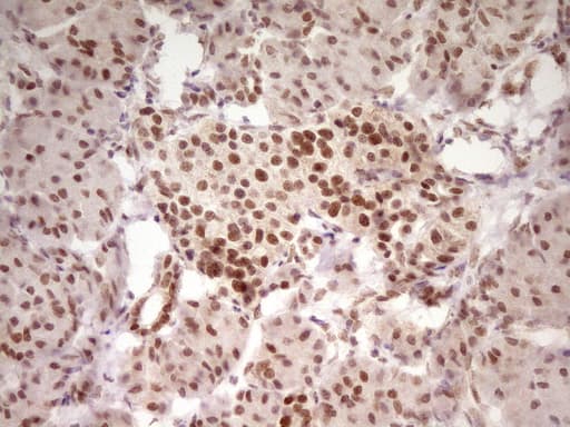 HMG20A Antibody (aa1-281, clone OTI5E4)
