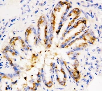 Polyclonal Rabbit anti-Human CAPN1 / Calpain 1 Antibody (aa313-327, IHC, WB)