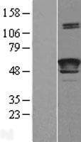 LCAT Protein (Over-Expression Lysate Myc-DDK (Flag))