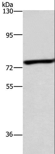 ABCB8 Antibody