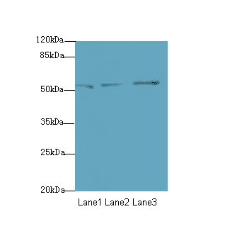 Polyclonal Rabbit anti-Human SLC46A2 Antibody (WB)