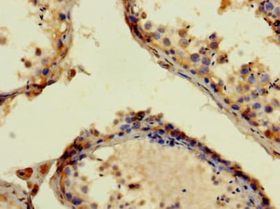 APP / Beta Amyloid Precursor Antibody (aa18-249)