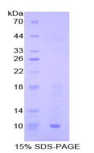 Rat CCL19 / MIP3-Beta Protein (Recombinant His)