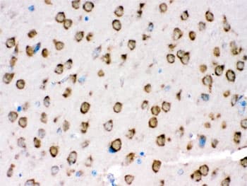 TRPM5 Antibody