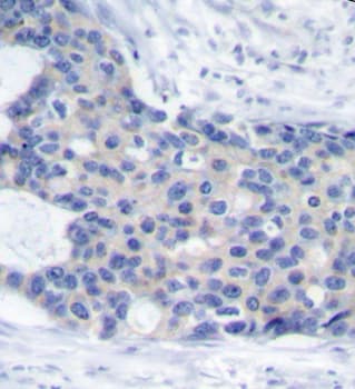 Polyclonal Rabbit anti-Human ZAP70 Antibody (phospho-Tyr493, IHC, WB)