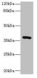 Polyclonal Rabbit anti-Human TMEM64 Antibody (IHC, WB)