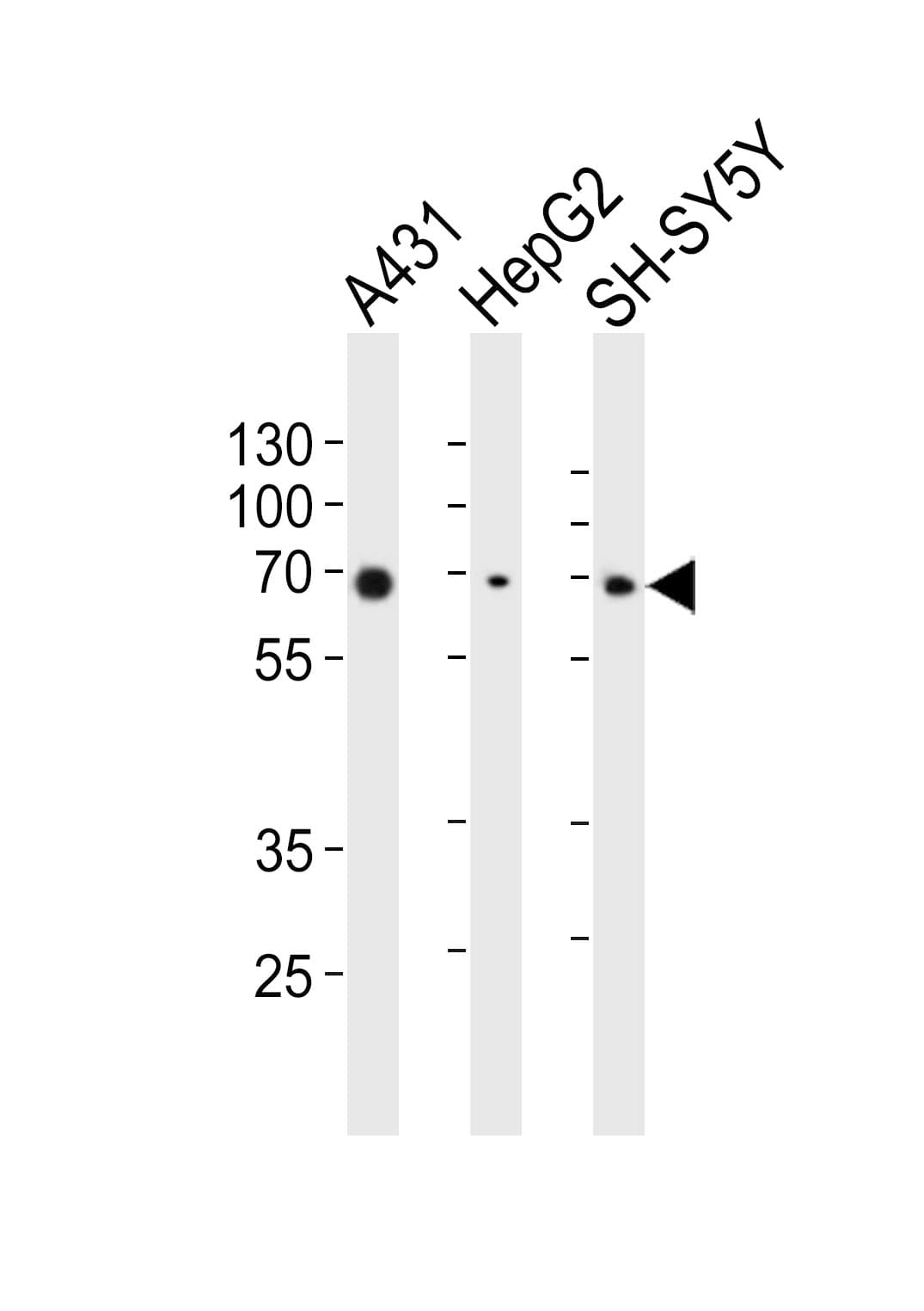 EIF2AK2 / PKR Antibody (clone 1441CT628.33.40)