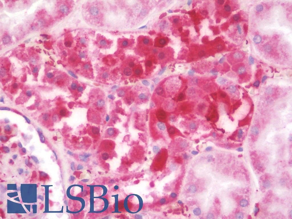 IHC-plus™ Polyclonal Rabbit anti-Human RPSA / Laminin Receptor Antibody (IHC, IF, WB)