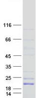 Human GP9 / CD42a Protein (Recombinant Myc-DDK (Flag))