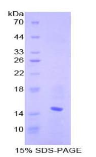 Mouse Ccl6 Protein (Recombinant His-T7)