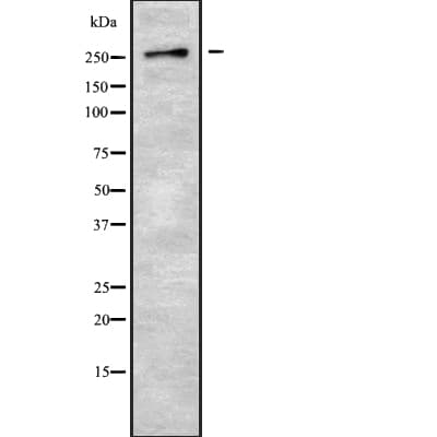 Polyclonal Rabbit anti-Human GPR179 Antibody (WB)